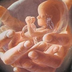 Приснился аборт — как узнать точное толкование сна